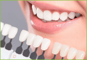 facette dentaire Tunisie