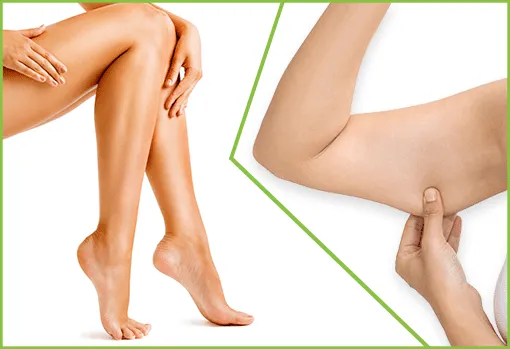 Lifting des membres Tunisie