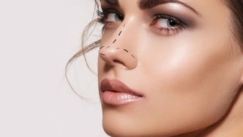 rhinoplastie Tunisie