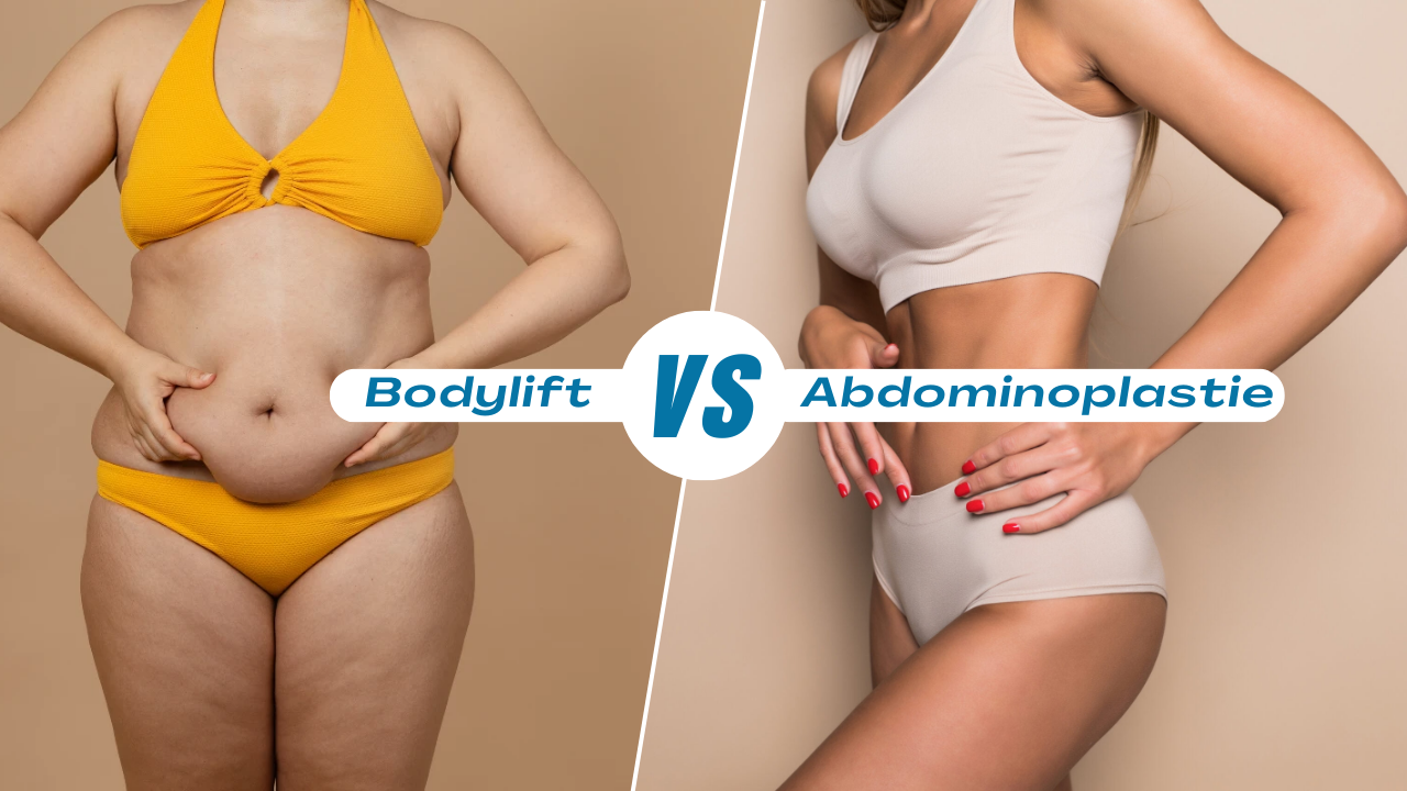 bodylift ou abdominoplastie en tunisie