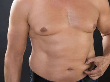 Liposuccion du ventre pour homme : tout ce qu’il faut savoir