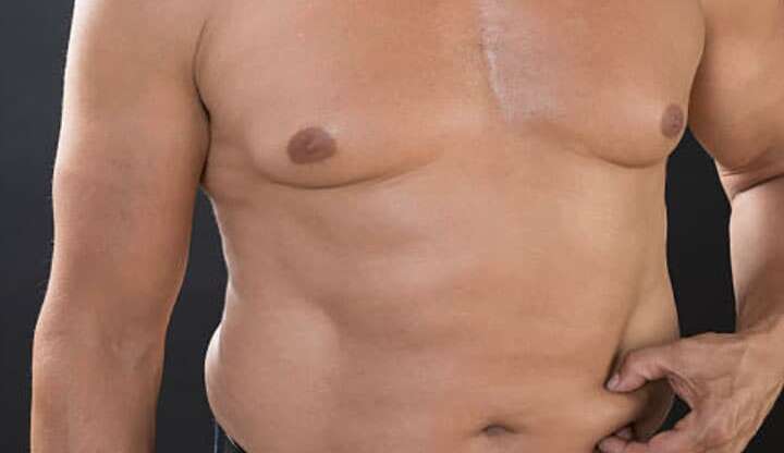 Liposuccion du ventre pour homme : tout ce qu’il faut savoir